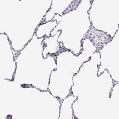 Immunohistochemistry-Paraffin: SP-B/Surfactant Protein B Antibody [NBP2-49359]