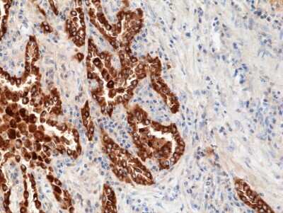Immunohistochemistry: SP-B/Surfactant Protein B Antibody (RM370) [NBP2-77431]