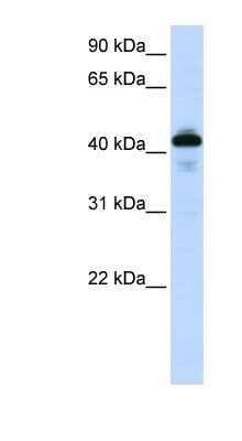 Western Blot: SP-B/Surfactant Protein B Antibody [NBP1-57977]