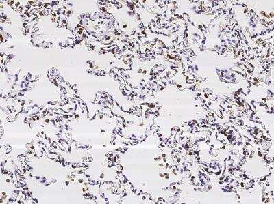 Immunohistochemistry-Paraffin: SP-D Antibody (001) [NBP2-90939]