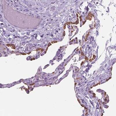 Immunohistochemistry-Paraffin: SP-D Antibody [NBP2-38803]