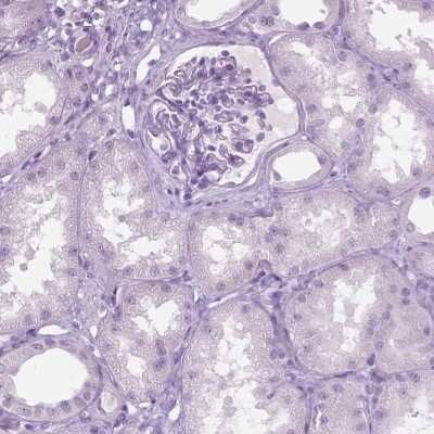 Immunohistochemistry-Paraffin: SP-D Antibody [NBP2-38803]
