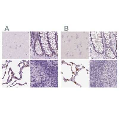 Immunohistochemistry-Paraffin: SP-D Antibody [NBP2-38803]