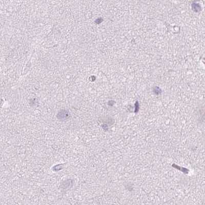 Immunohistochemistry-Paraffin: SP-D Antibody [NBP2-38803]