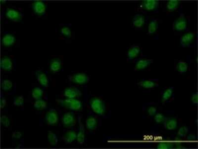 Immunocytochemistry/ Immunofluorescence: SP1 Antibody (1A5) [H00006667-M02]