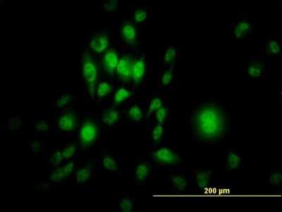 Immunocytochemistry/ Immunofluorescence: SP1 Antibody (4C8) [H00006667-M03]
