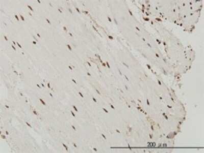 Immunohistochemistry-Paraffin: SP1 Antibody (4C8) [H00006667-M03]