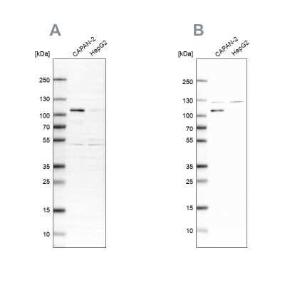 Western Blot: SP1 Antibody [NBP1-85812]