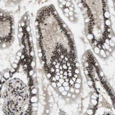 Immunohistochemistry-Paraffin: SP100 Antibody [NBP1-89457]
