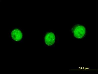 Immunocytochemistry/ Immunofluorescence: SP110 Antibody (2G10) [H00003431-M03]