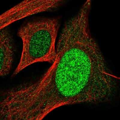 Immunocytochemistry/ Immunofluorescence: SP110 Antibody [NBP2-56189]