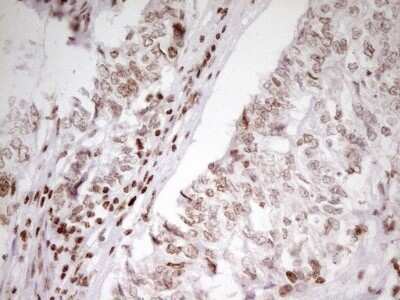 Immunohistochemistry: SP110 Antibody (OTI4C1) - Azide and BSA Free [NBP2-74306]