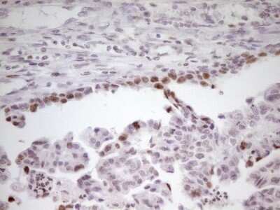 Immunohistochemistry: SP110 Antibody (OTI4C1) - Azide and BSA Free [NBP2-74306]