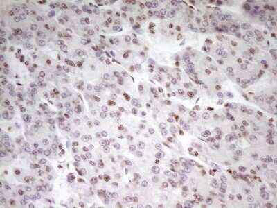 Immunohistochemistry: SP110 Antibody (OTI4C1) - Azide and BSA Free [NBP2-74306]