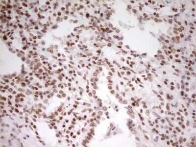 Immunohistochemistry: SP110 Antibody (OTI4C1) - Azide and BSA Free [NBP2-74306]