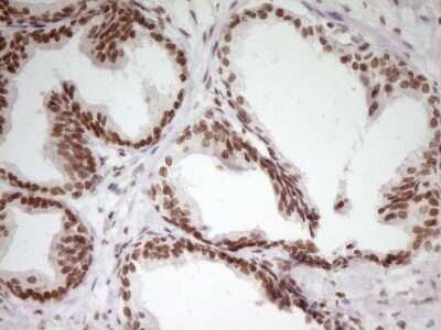 Immunohistochemistry: SP110 Antibody (OTI4C1) - Azide and BSA Free [NBP2-74306]