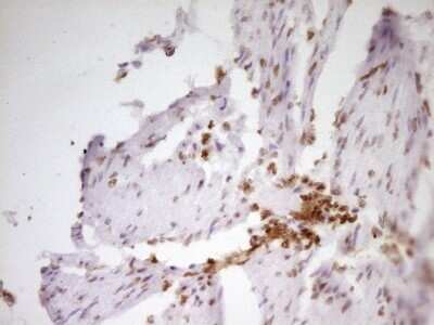 Immunohistochemistry: SP110 Antibody (OTI4C1) - Azide and BSA Free [NBP2-74306]