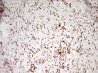 Immunohistochemistry: SP110 Antibody (OTI4C1) - Azide and BSA Free [NBP2-74306]