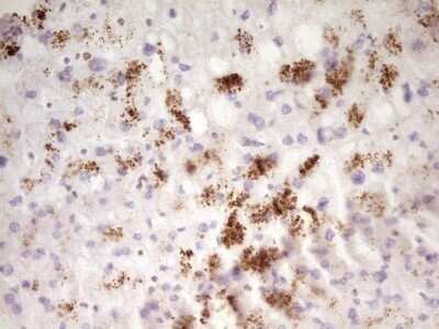 Immunohistochemistry: SP110 Antibody (OTI4C1) - Azide and BSA Free [NBP2-74306]