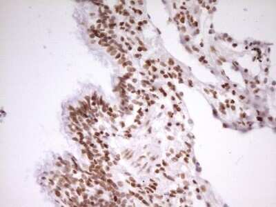 Immunohistochemistry: SP110 Antibody (OTI4C1) - Azide and BSA Free [NBP2-74306]