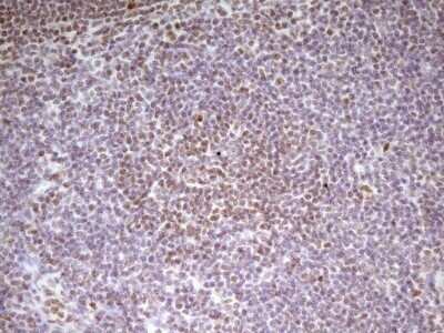 Immunohistochemistry: SP110 Antibody (OTI4C1) - Azide and BSA Free [NBP2-74306]