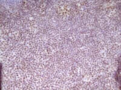 Immunohistochemistry: SP110 Antibody (OTI4C1) - Azide and BSA Free [NBP2-74306]