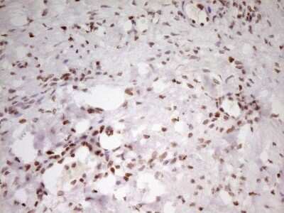 Immunohistochemistry: SP110 Antibody (OTI4C1) - Azide and BSA Free [NBP2-74306]