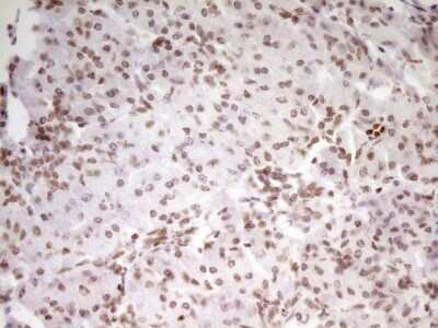 Immunohistochemistry: SP110 Antibody (OTI4C1) - Azide and BSA Free [NBP2-74306]