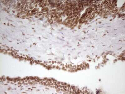 Immunohistochemistry: SP110 Antibody (OTI4C1) - Azide and BSA Free [NBP2-74306]