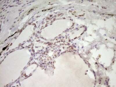 Immunohistochemistry: SP110 Antibody (OTI4C1) - Azide and BSA Free [NBP2-74306]