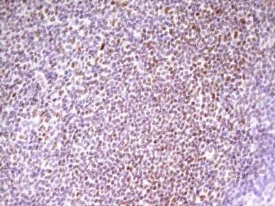 Immunohistochemistry: SP110 Antibody (OTI4C1) - Azide and BSA Free [NBP2-74306]