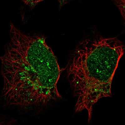 Immunocytochemistry/ Immunofluorescence: SP140 Antibody [NBP2-49517]