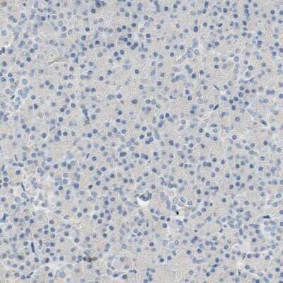 Immunohistochemistry-Paraffin: SP140 Antibody [NBP1-81275]