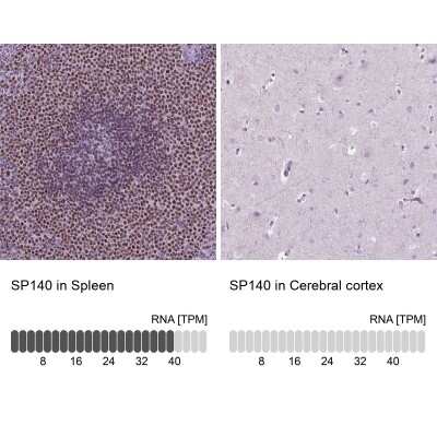 Immunohistochemistry-Paraffin: SP140 Antibody [NBP2-49517]