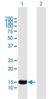 Western Blot: SP140 Antibody [H00011262-B01P]