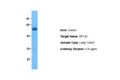 Western Blot: SP140 Antibody [NBP1-80009]