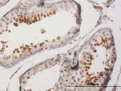 Immunohistochemistry-Paraffin: SP17 Antibody [H00053340-B01P]