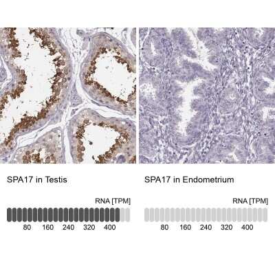Immunohistochemistry-Paraffin: SP17 Antibody [NBP1-85409]