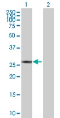 Western Blot: SP2 Antibody [H00006668-B01P]