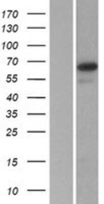 Western Blot: SP2 Overexpression Lysate [NBP2-08037]