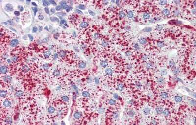 Immunohistochemistry: SP4 Antibody [NBP2-83576]