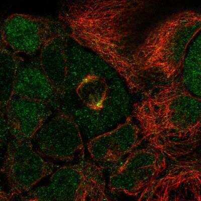 Immunocytochemistry/ Immunofluorescence: SP6 Antibody [NBP1-92428]