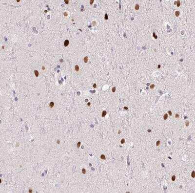 Immunohistochemistry-Paraffin: SP9 Antibody [NBP2-38967]