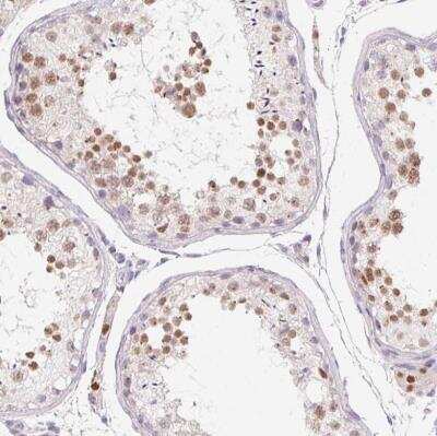 Immunohistochemistry-Paraffin: SP9 Antibody [NBP2-38967]