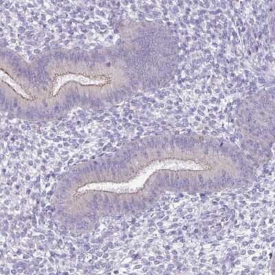 Immunohistochemistry-Paraffin: SPACA1 Antibody [NBP2-38506]