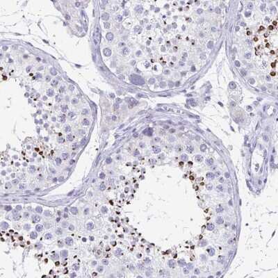 Immunohistochemistry-Paraffin: SPACA1 Antibody [NBP2-38506]