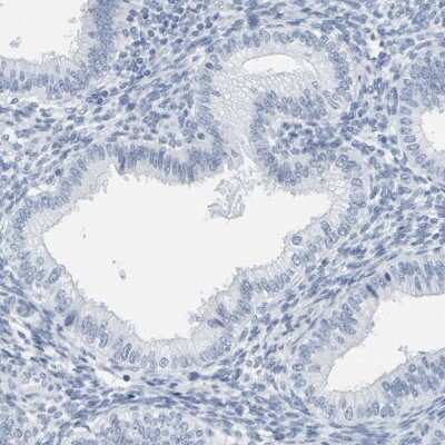 Immunohistochemistry-Paraffin: SPACA3 Antibody [NBP1-89136]
