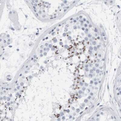 Immunohistochemistry-Paraffin: SPACA3 Antibody [NBP1-89136]