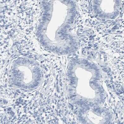 Immunohistochemistry-Paraffin: SPACA3 Antibody [NBP1-89136]