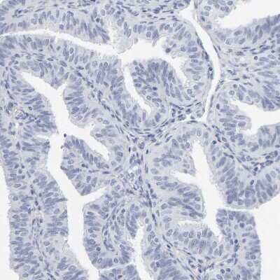 Immunohistochemistry-Paraffin: SPACA3 Antibody [NBP1-89136]
